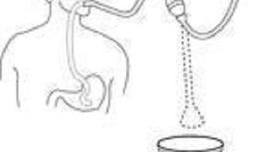 插胃管操作视频,步骤与技巧全解析